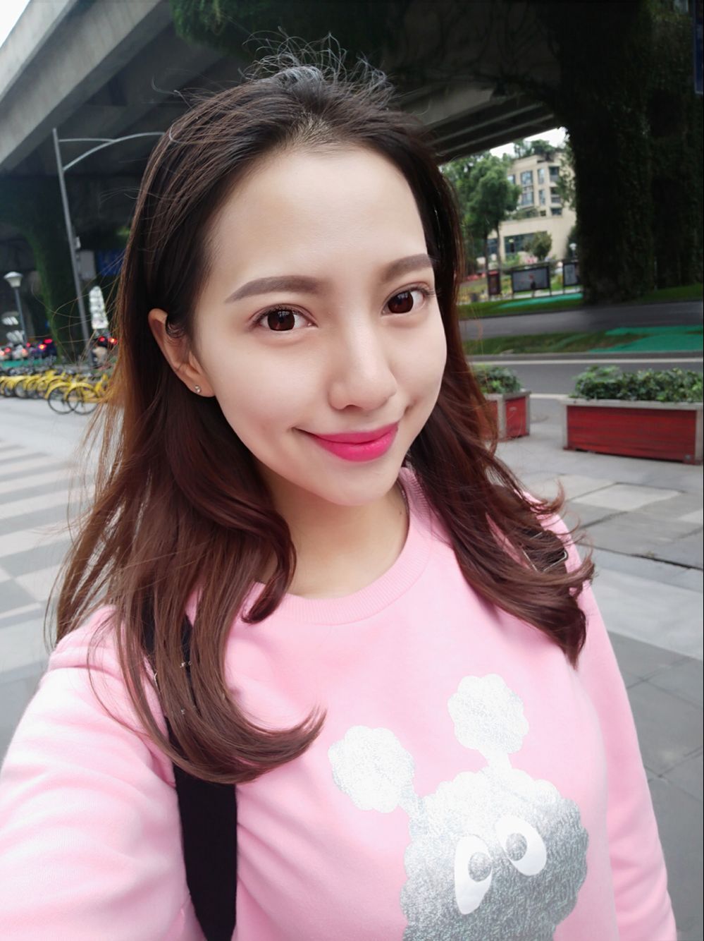 保定東陽口腔醫(yī)院溫興醫(yī)生做牙齒矯正怎么樣？附牙齒矯正案例效果對比圖