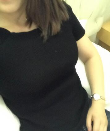 保定現(xiàn)代女子醫(yī)院整形美容中心做腰腹部吸脂怎么樣？附林秀蓮醫(yī)生案例效果圖