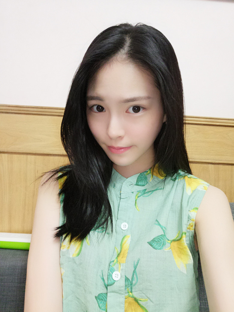 保定市第五醫(yī)院美容整形科做激光祛斑怎么樣？附單敬依醫(yī)生案例效果圖