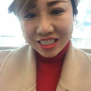 保定東陽口腔醫(yī)院趙晨醫(yī)生做瓷貼面怎么樣？附瓷貼面案例效果對比圖