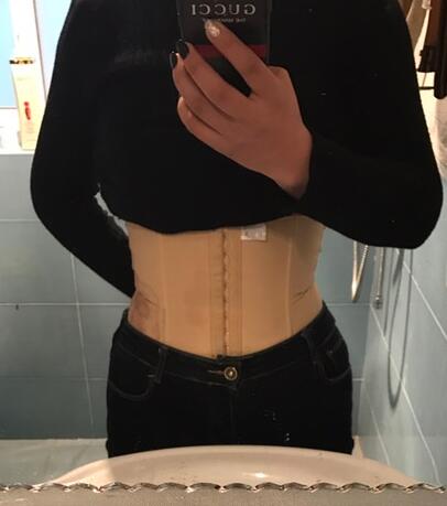 保定現(xiàn)代女子醫(yī)院整形美容中心做腰腹部吸脂怎么樣？附林秀蓮醫(yī)生案例效果圖