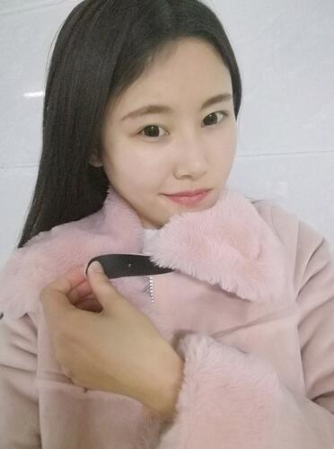 蘇州愛(ài)思特醫(yī)療美容醫(yī)院下頜角整形術(shù)后效果