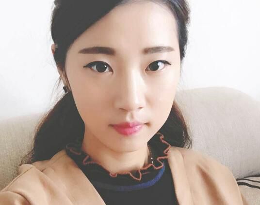 蘇州愛思特醫(yī)療美容醫(yī)院雙眼皮術(shù)前效果