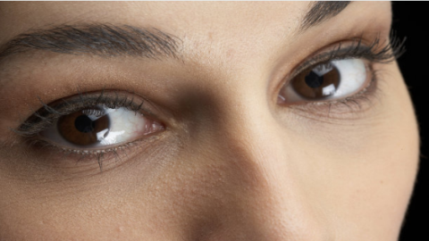 埋線雙眼皮需要多少錢？埋線雙眼皮需要取線嗎？