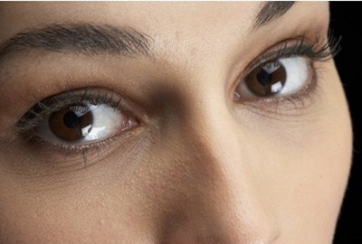 隆鼻假體能保持幾年？