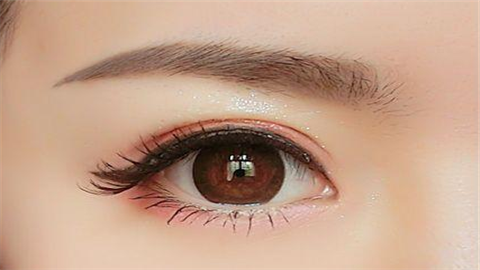 雙眼皮埋線是什么線？
