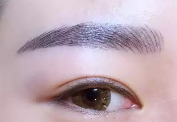 除皺去眼袋需要多少錢？價格貴嗎？