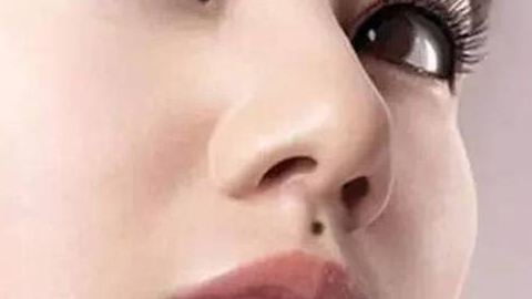 綜合隆鼻價(jià)格需要多少錢？價(jià)格貴嗎？