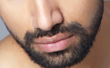 種植胡須大概多少錢？價錢貴嗎？