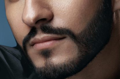 種植胡須后遺癥有哪些？