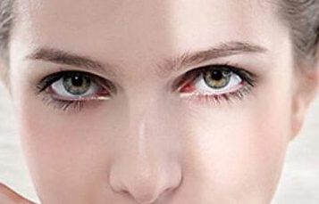 激光祛痘需要多長時間？能維持多久？