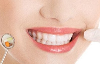 美容冠矯正是什么意思？