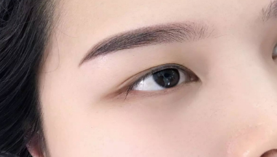 開眼角一般需要多少錢？