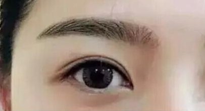 近視矯正手術(shù)的年齡范圍是多大？