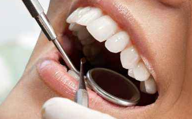 種植牙多少錢一顆？種植牙通常需要幾次完成？