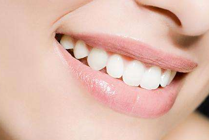 自鎖托槽矯正需要多久？