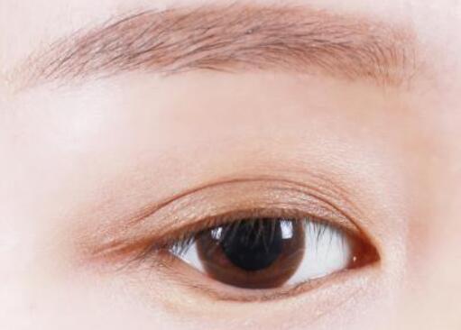 雙眼皮的寬度怎么選擇，多少mm合適？