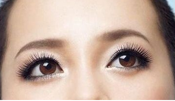 做完雙眼皮手術(shù)要忌口多長(zhǎng)時(shí)間？