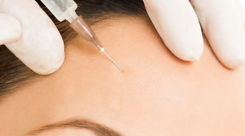 水光針的價(jià)格是多少錢一針？手術(shù)價(jià)錢便宜嗎？