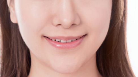 玻尿酸豐唇大概需要多少錢？