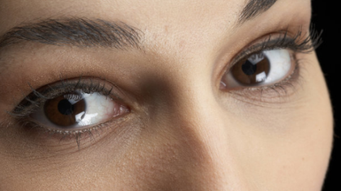 玻尿酸填充淚溝需要多少錢？