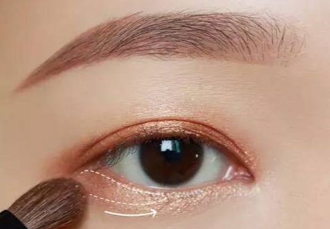 全切雙眼皮術(shù)后多久拆線？