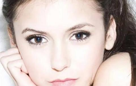 全切雙眼皮會(huì)留疤嗎？全切雙眼皮的優(yōu)勢(shì)有哪些？