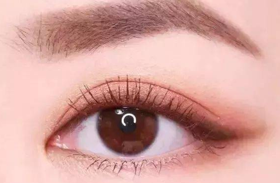 全切雙眼皮有什么副作用？