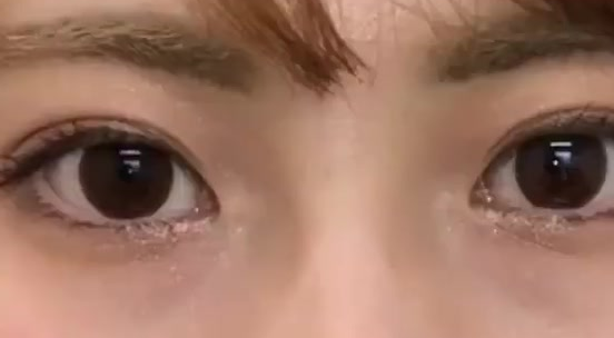 做埋線雙眼皮有什么危險？