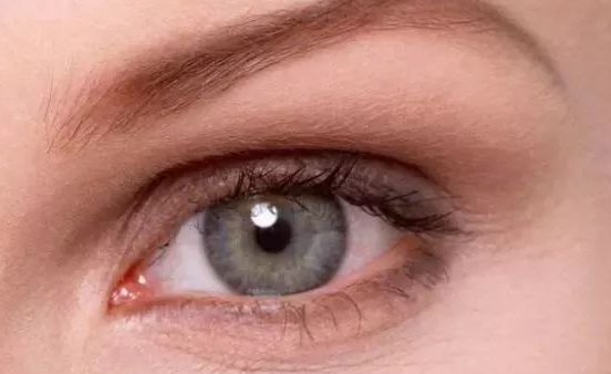 埋線雙眼皮能保持幾年？