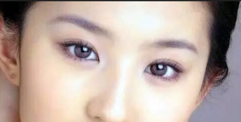 定點(diǎn)雙眼皮會有疤痕嗎？