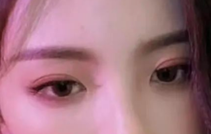 割雙眼皮會(huì)有疤痕嗎？