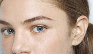 單眼皮割雙眼皮會留疤嗎？