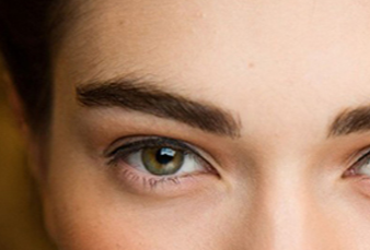 韓式開眼角的恢復期要多久？