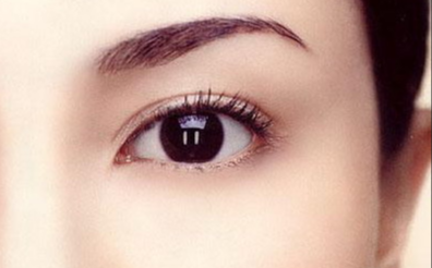 韓式開眼角多久恢復(fù)自然？韓式開眼角的特點有哪些？