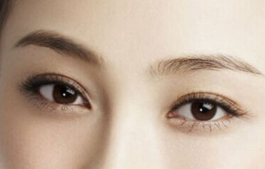 韓式開眼角手術(shù)的恢復(fù)時間？