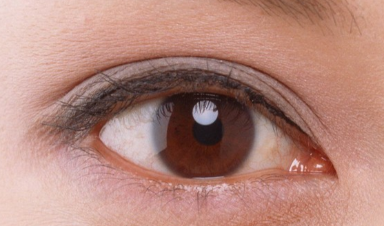 韓式開眼角安全嗎？韓式開眼角半個(gè)月能消腫嗎？