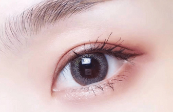 開(kāi)內(nèi)眼角大概需要多久恢復(fù)？