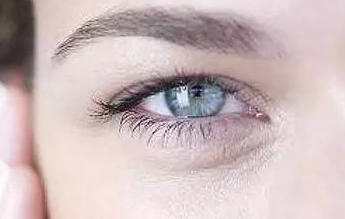 開內(nèi)眼角的弊端有哪些？