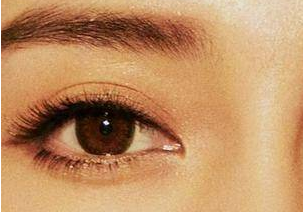 開眼角的恢復是多久？