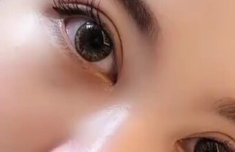 開眼角有沒有風(fēng)險？