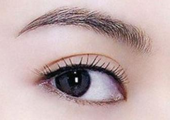 外眼角開手術(shù)多少錢？開外眼角手術(shù)是怎么進(jìn)行的？