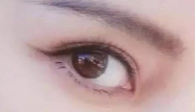 開眼角需要多久才能恢復？