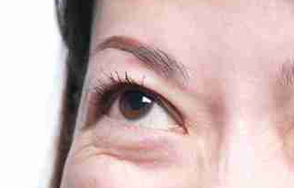 光纖溶脂祛眼袋好不好？