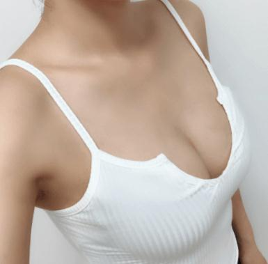 自體隆胸整形醫(yī)院哪家好？2022全國比較權(quán)威的隆胸醫(yī)院排名