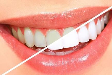 杭州牙齒種植整形醫(yī)院哪家好？2022排行榜前六實力強大！