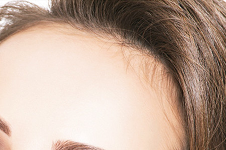 武漢植發(fā)整形醫(yī)院排名更新！實力口碑醫(yī)院推薦！