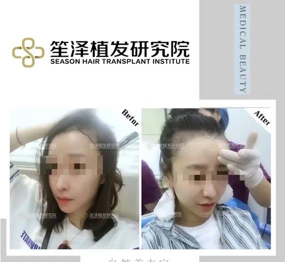 長沙笙澤植發(fā)研究院 長沙笙澤植發(fā)研究院