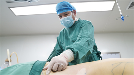 常熟瑞麗美貝爾美容醫(yī)院_吸脂過(guò)程