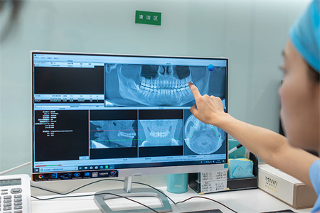 西安瑞泰口腔醫(yī)院_牙齒ct